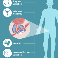 prostate